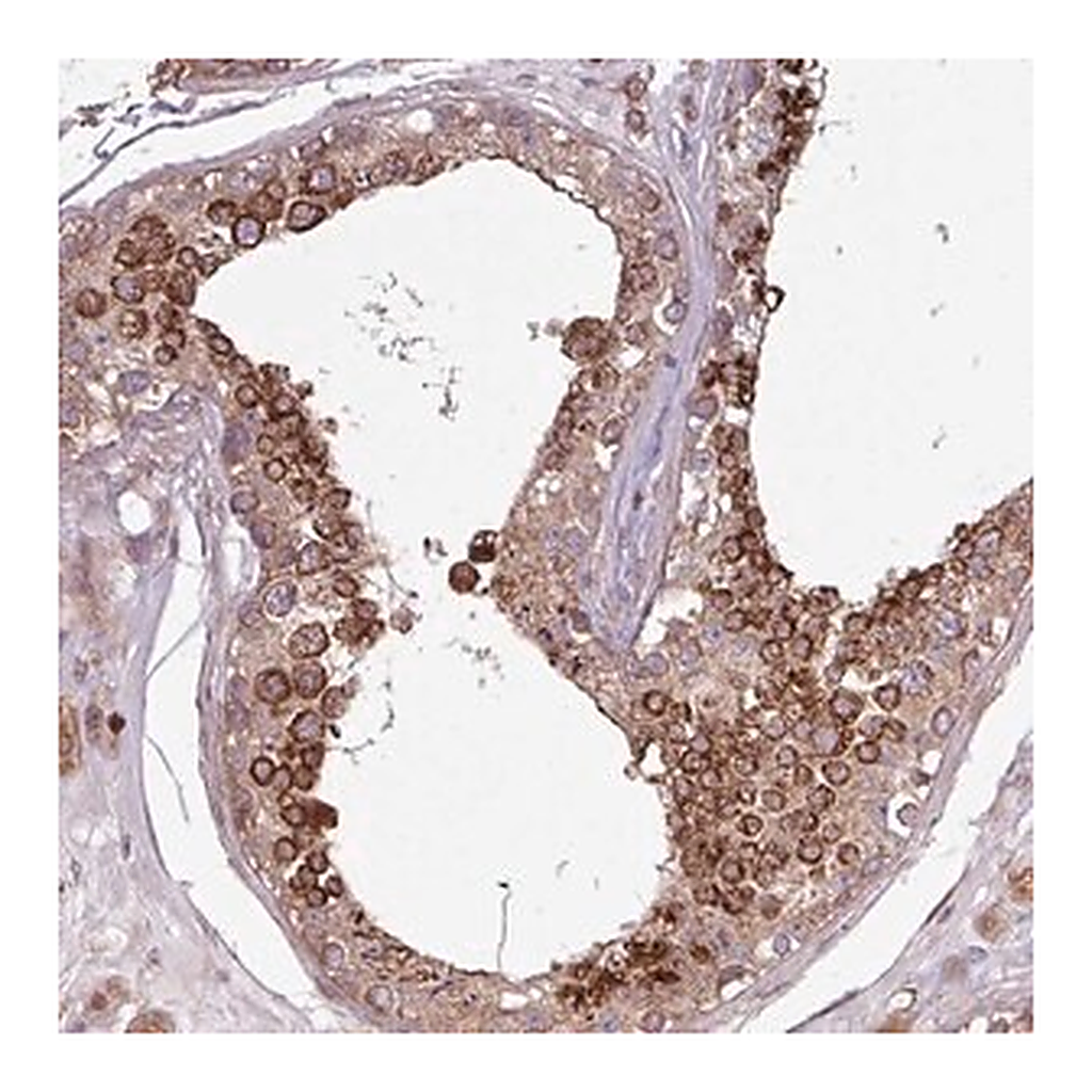 Merck Anti-PDPR antibody produced in rabbit