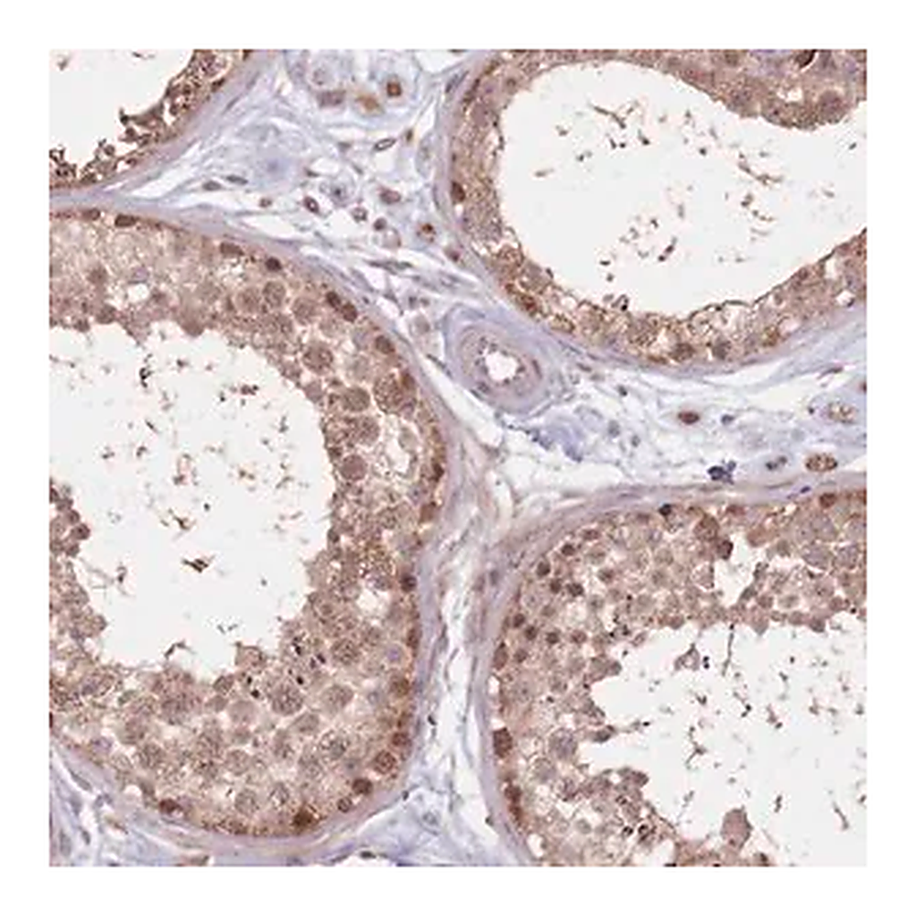 Merck Anti-VPS52 antibody produced in rabbit