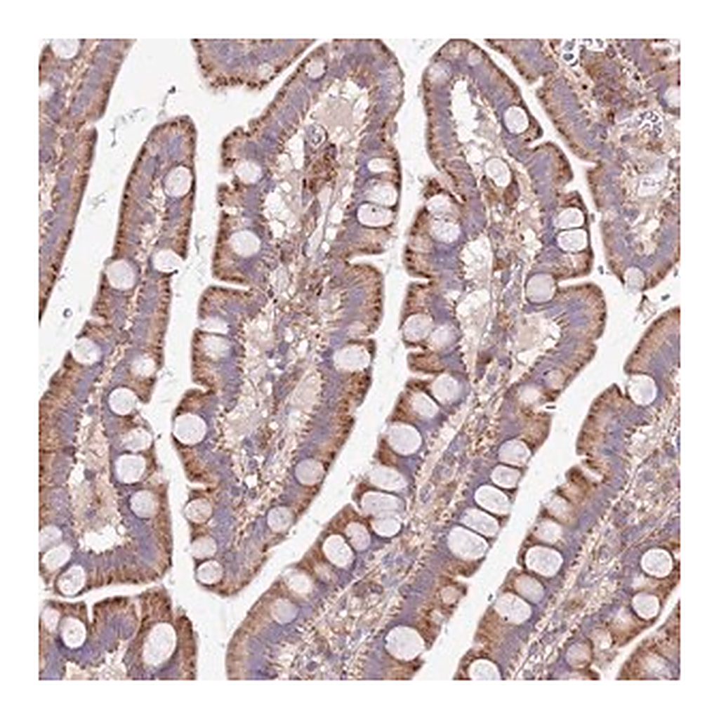 Merck Anti-ARMCX6 antibody produced in rabbit