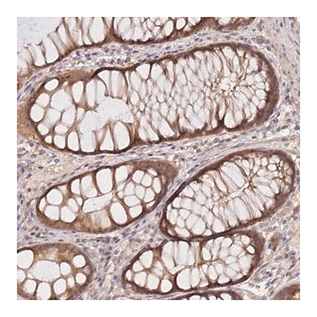 Merck Anti-KIAA1191 antibody produced in rabbit