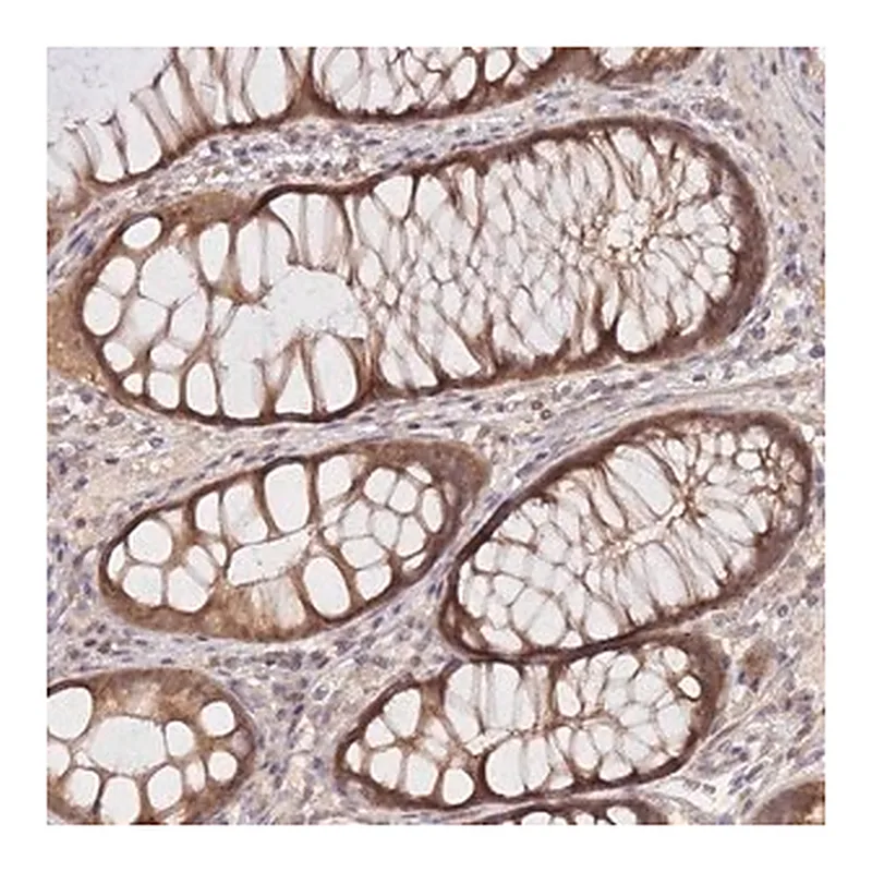 Merck Anti-KIAA1191 antibody produced in rabbit