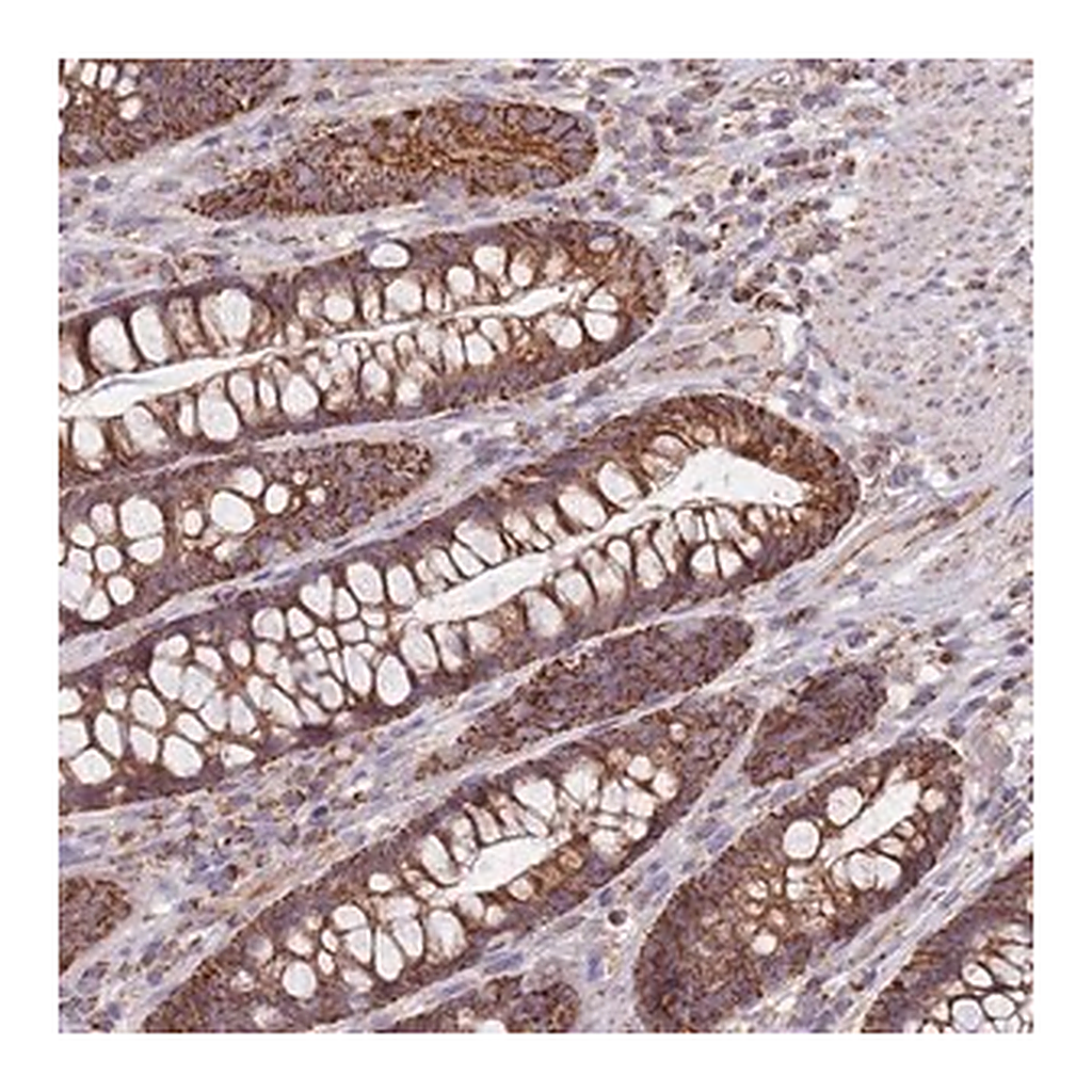 Merck Anti-VPS16 antibody produced in rabbit
