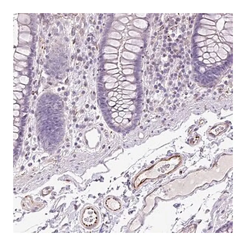 Merck Anti-AL592183.1 antibody produced in rabbit