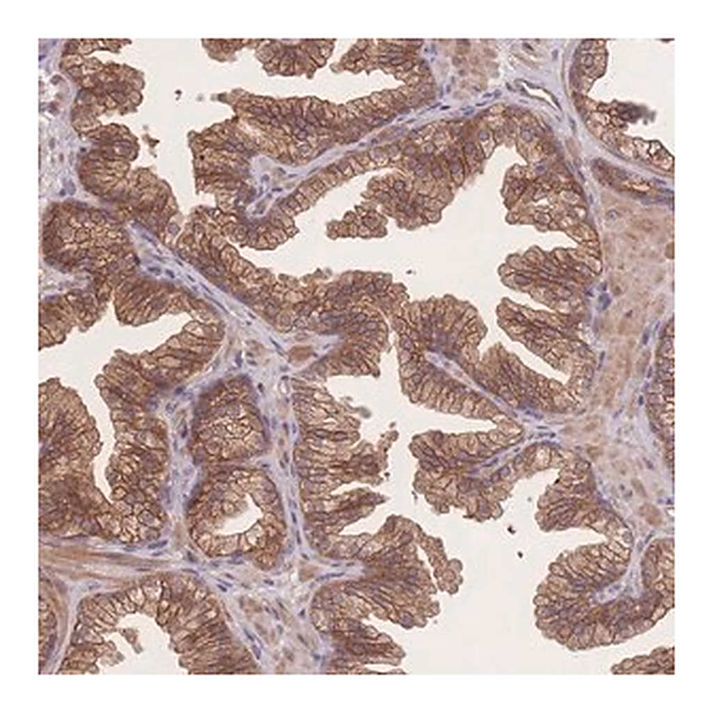 Merck Anti-CFAP97 antibody produced in rabbit