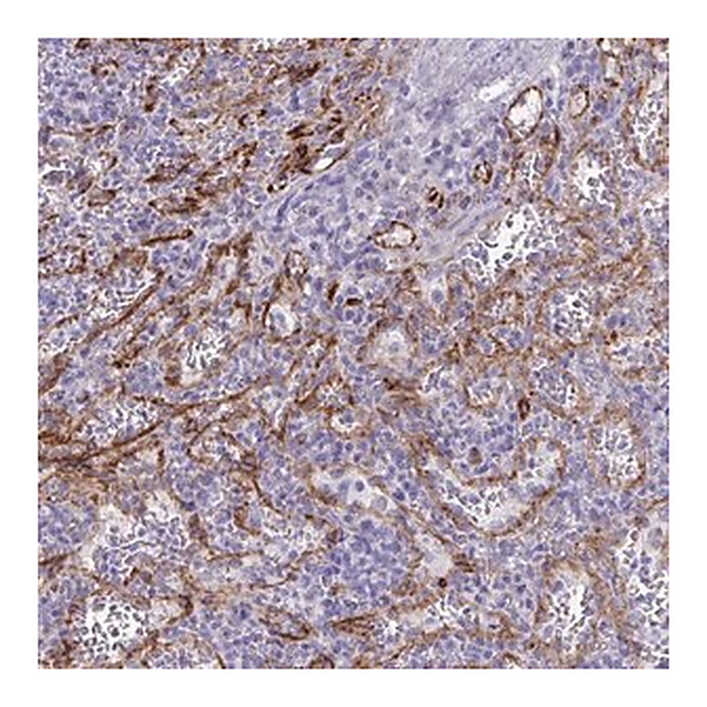 Merck Anti-KRIT1 antibody produced in rabbit