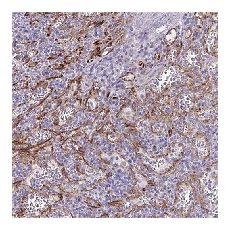 Merck Anti-KRIT1 antibody produced in rabbit