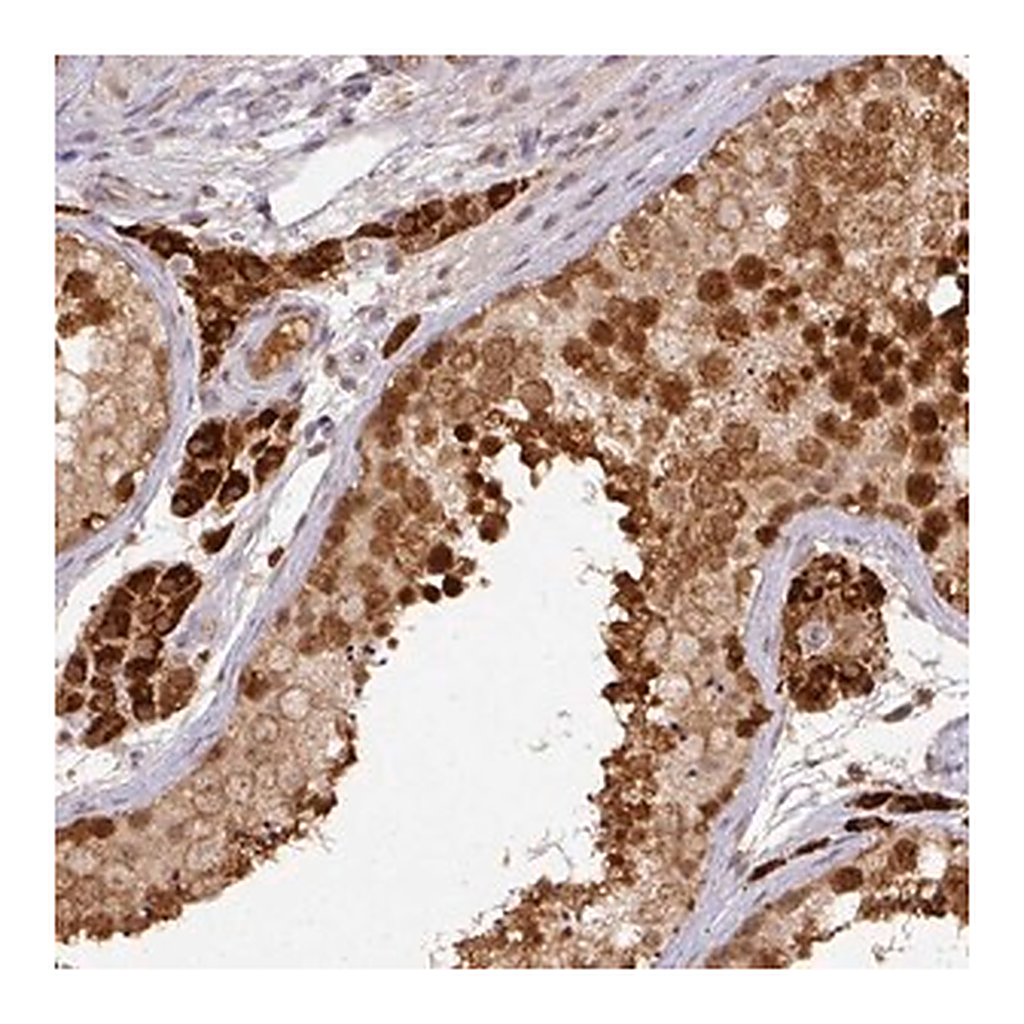Merck Anti-RANBP9 antibody produced in rabbit