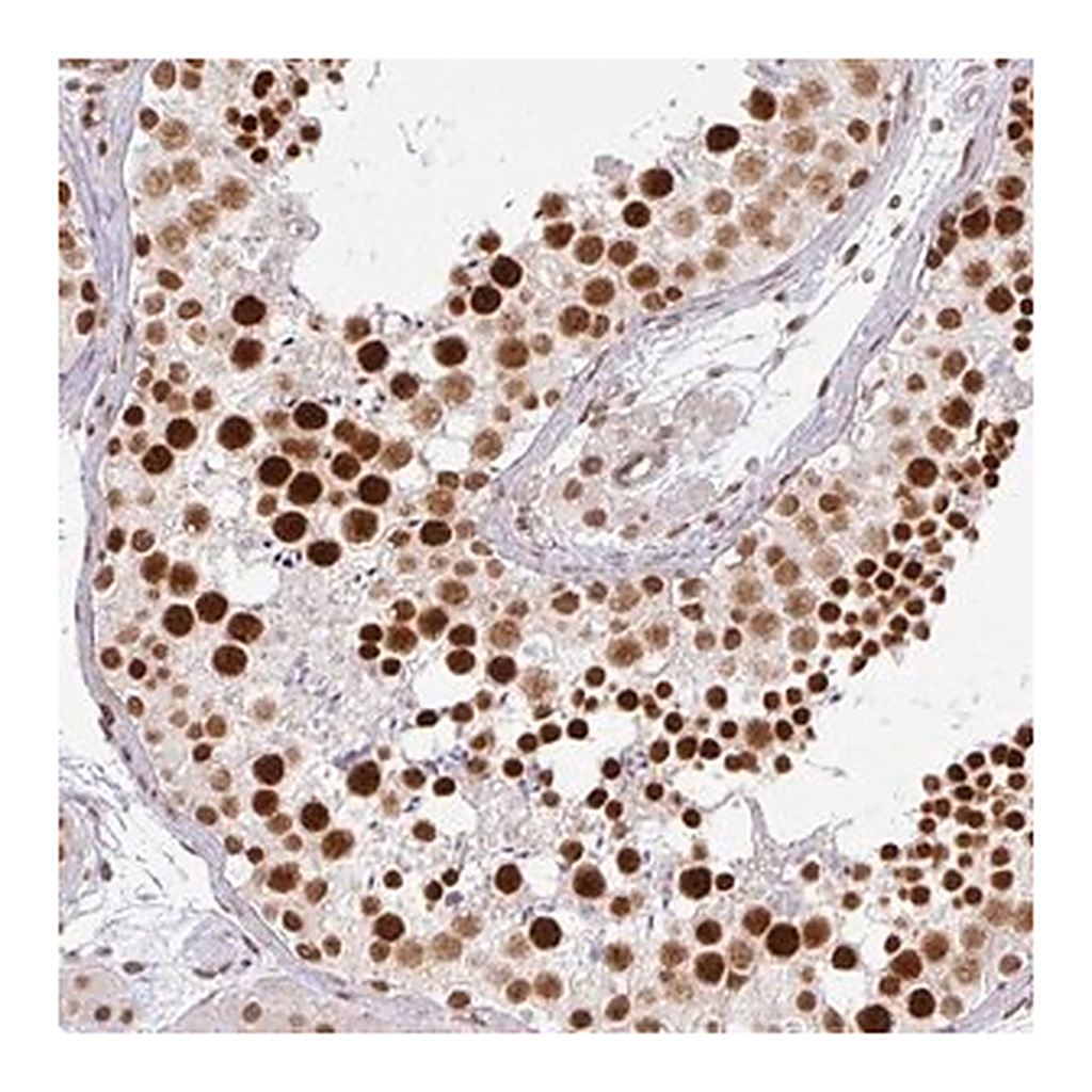 Merck Anti-NCOA5 antibody produced in rabbit