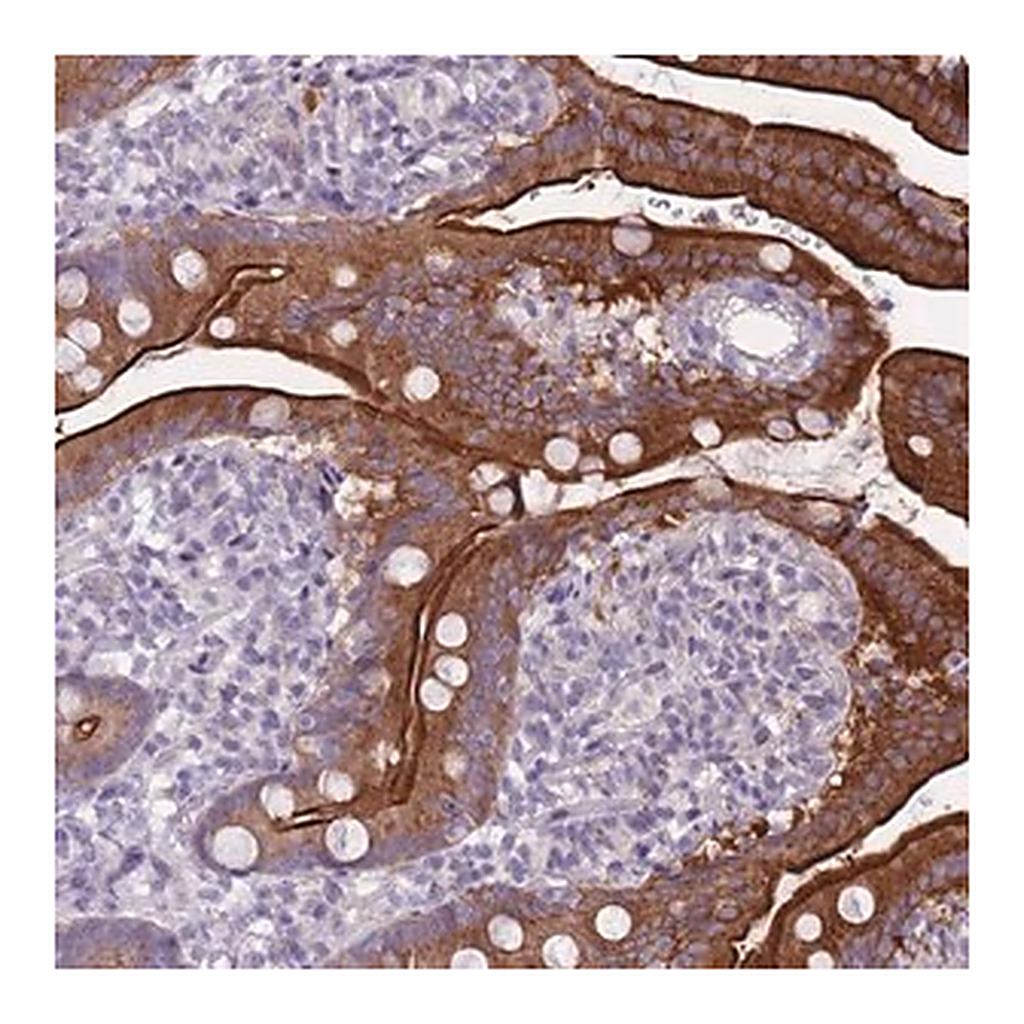 Merck Anti-HOOK2 antibody produced in rabbit