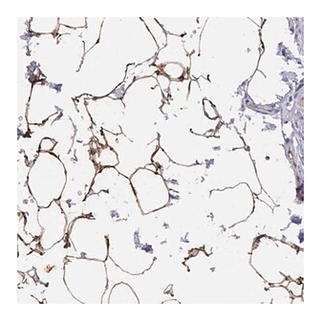 Merck Anti-TUSC5 antibody produced in rabbit