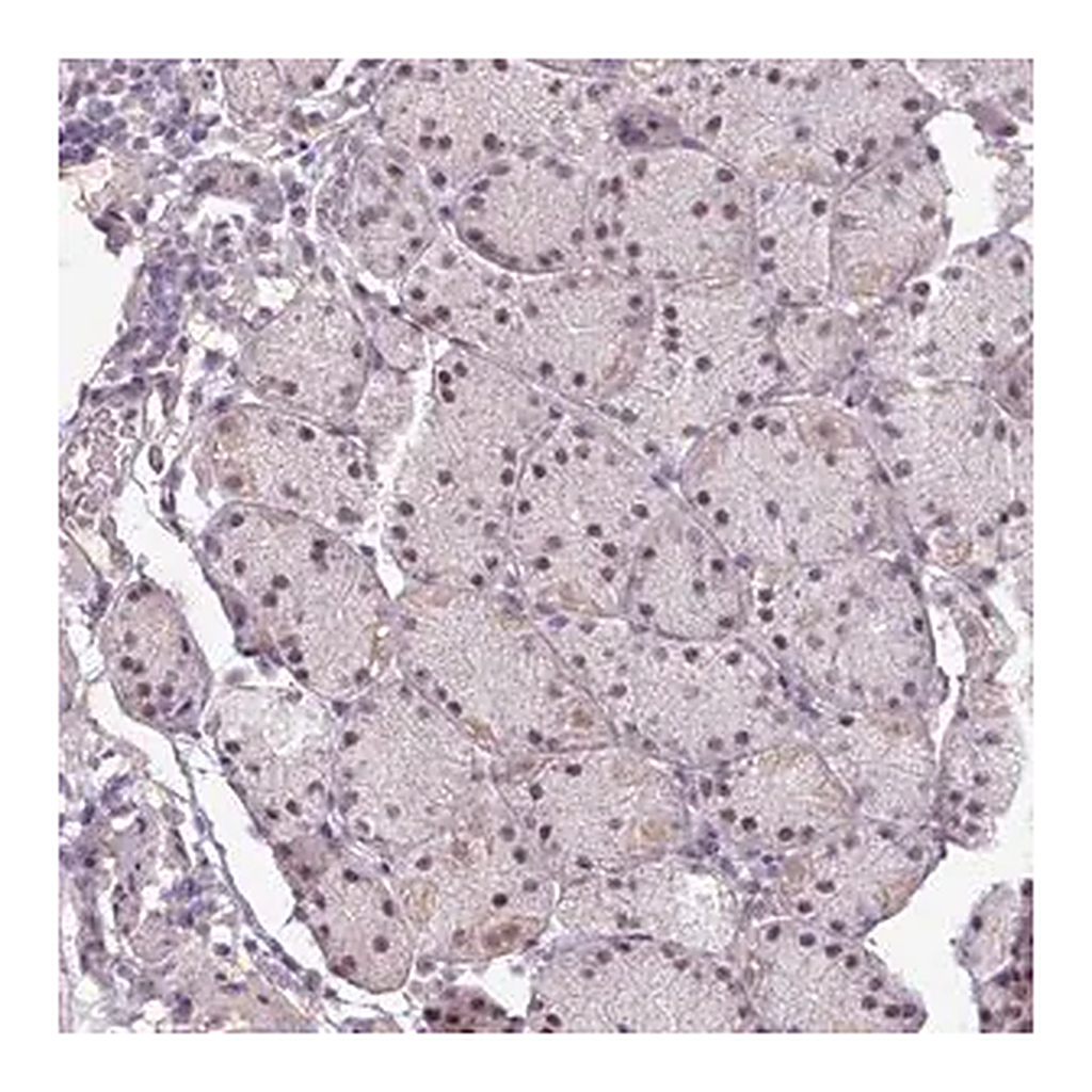Merck Anti-UVSSA antibody produced in rabbit