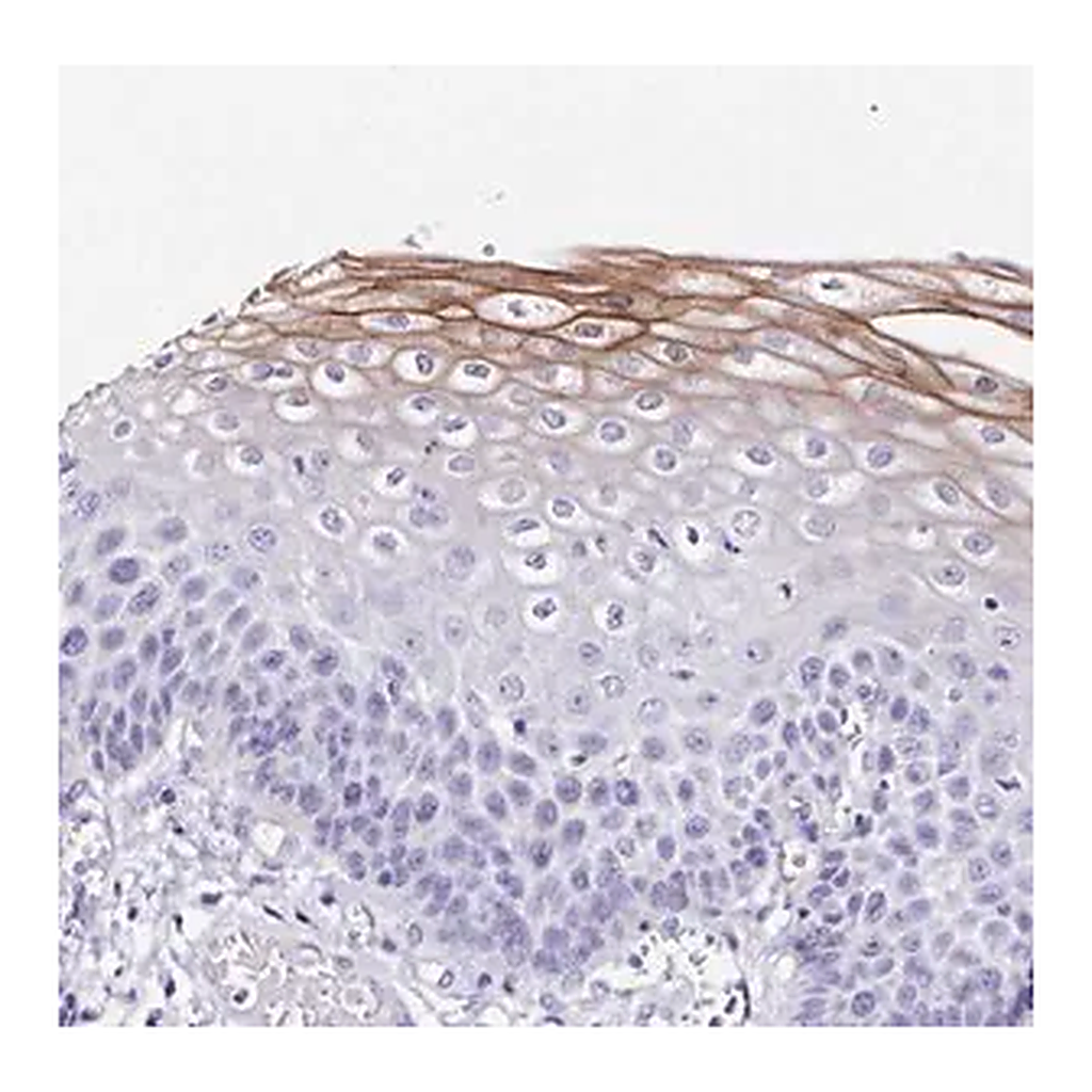 Merck Anti-TMPRSS11E antibody produced in rabbit