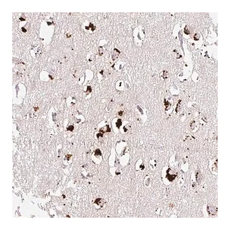Merck Anti-CLEC3A antibody produced in rabbit