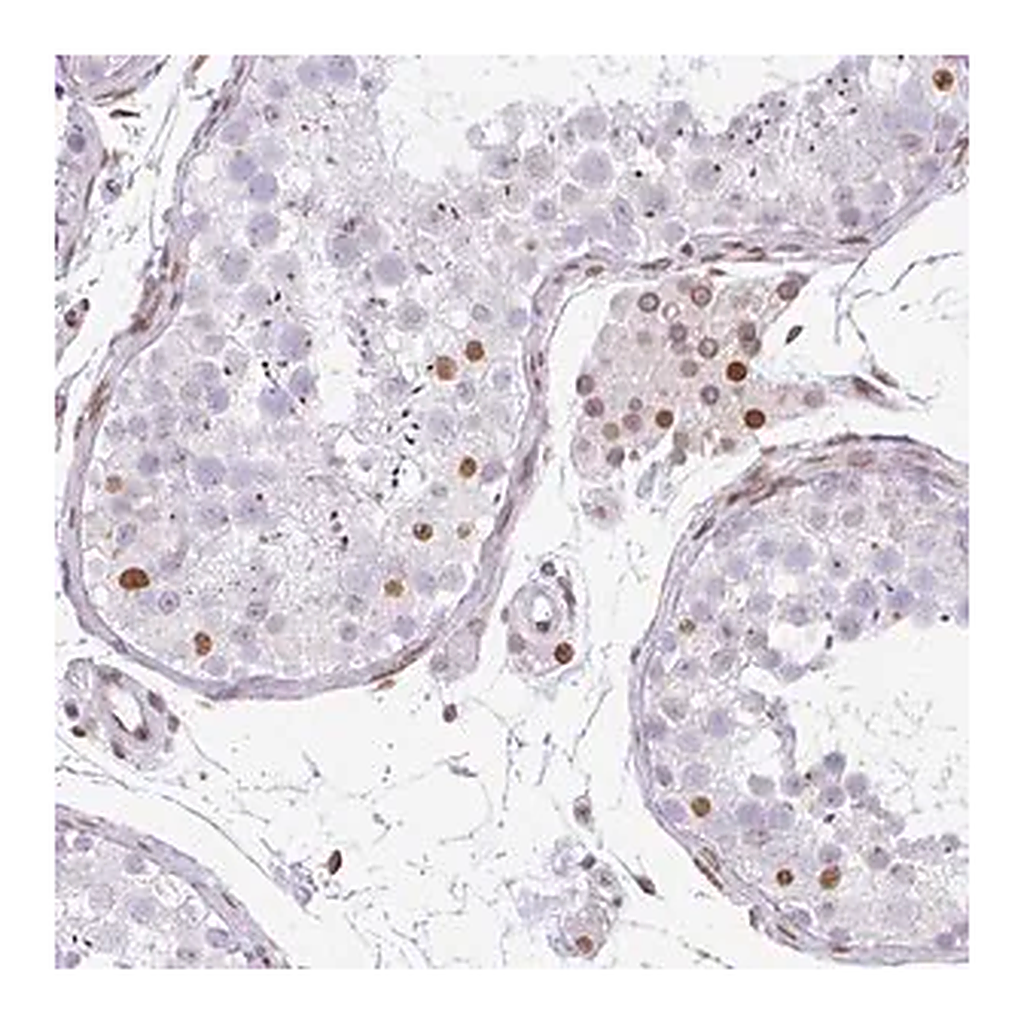 Merck Anti-PLK1 antibody produced in rabbit