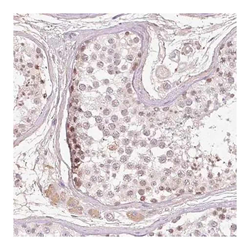 Merck Anti-TDRD15 antibody produced in rabbit