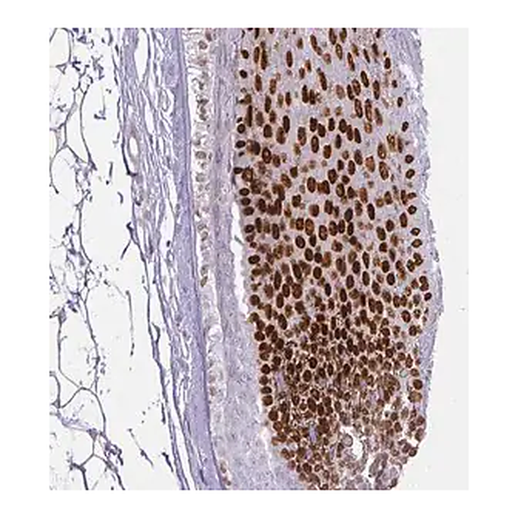 Merck Anti-HOXC13 antibody produced in rabbit