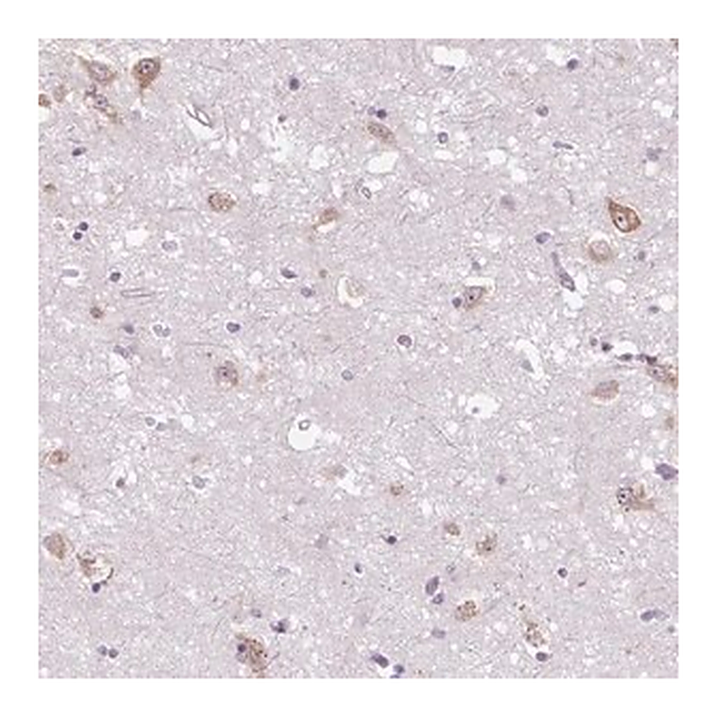 Merck Anti-FZD5 antibody produced in rabbit