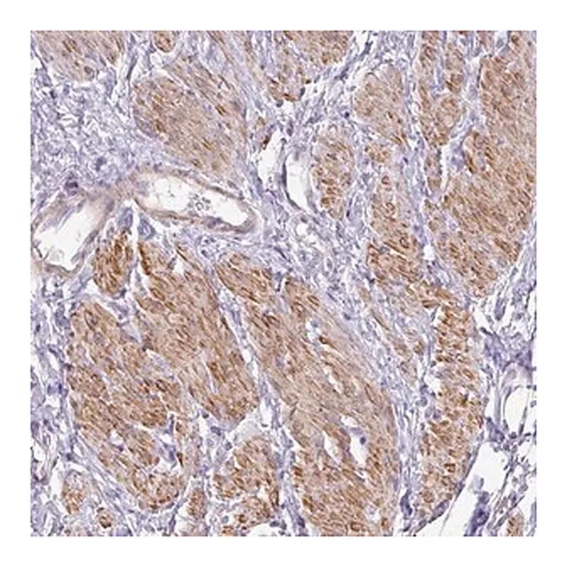 Merck Anti-DIP2A antibody produced in rabbit