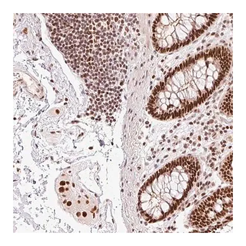 Merck Anti-ZBTB44 antibody produced in rabbit