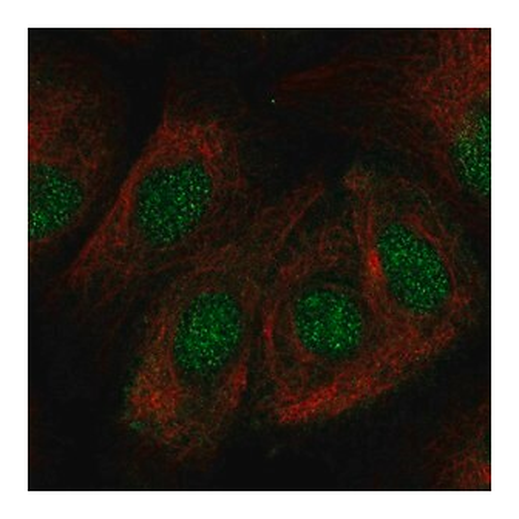 Merck Anti-ZNF319 antibody produced in rabbit