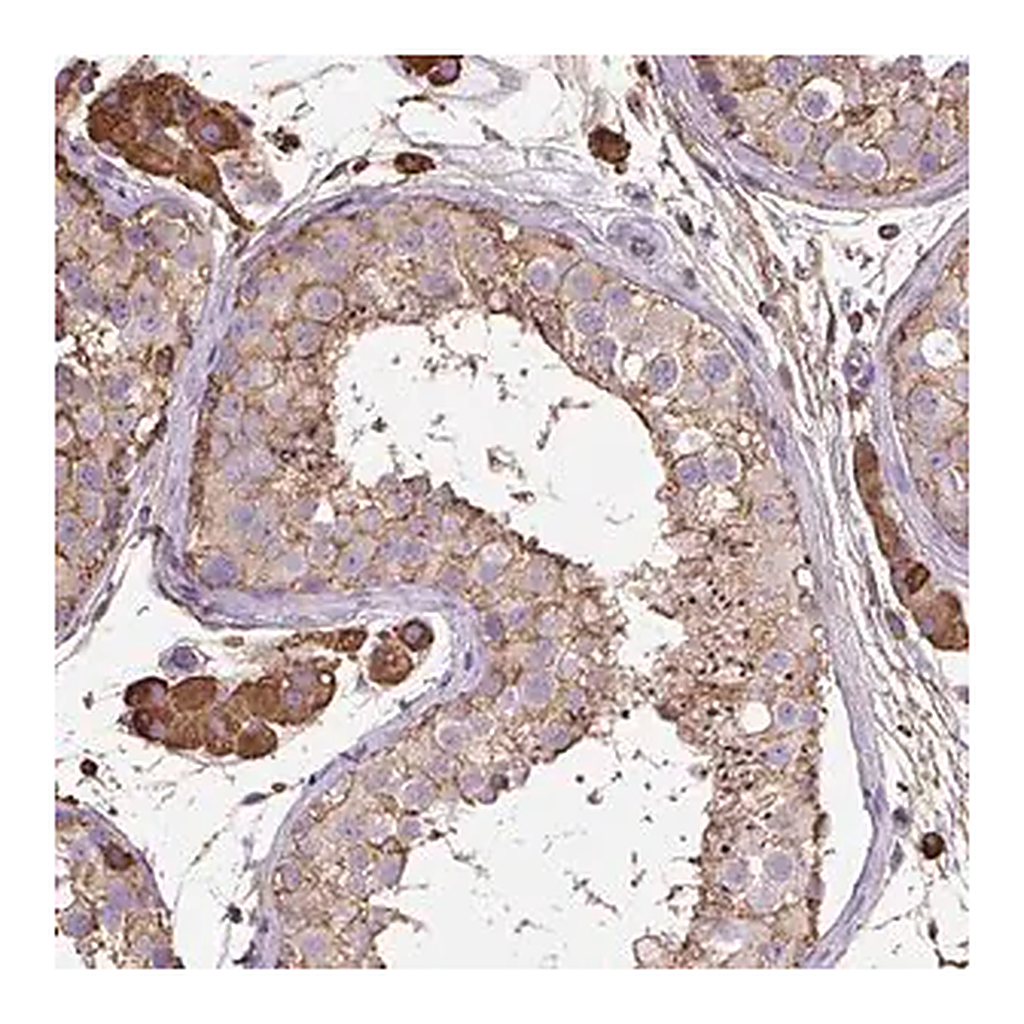 Merck Anti-MAGEB5 antibody produced in rabbit