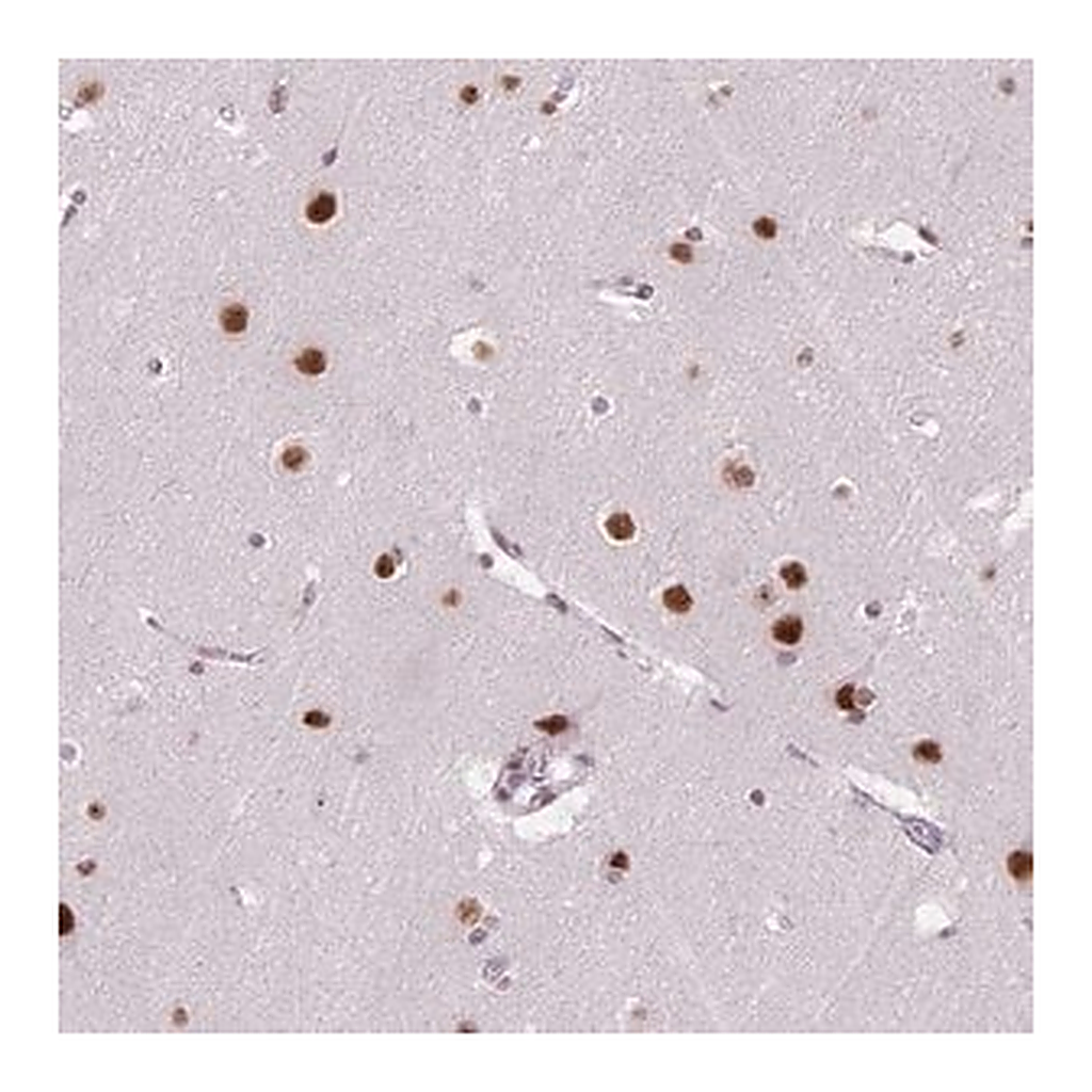 Merck Anti-C2orf82 antibody produced in rabbit