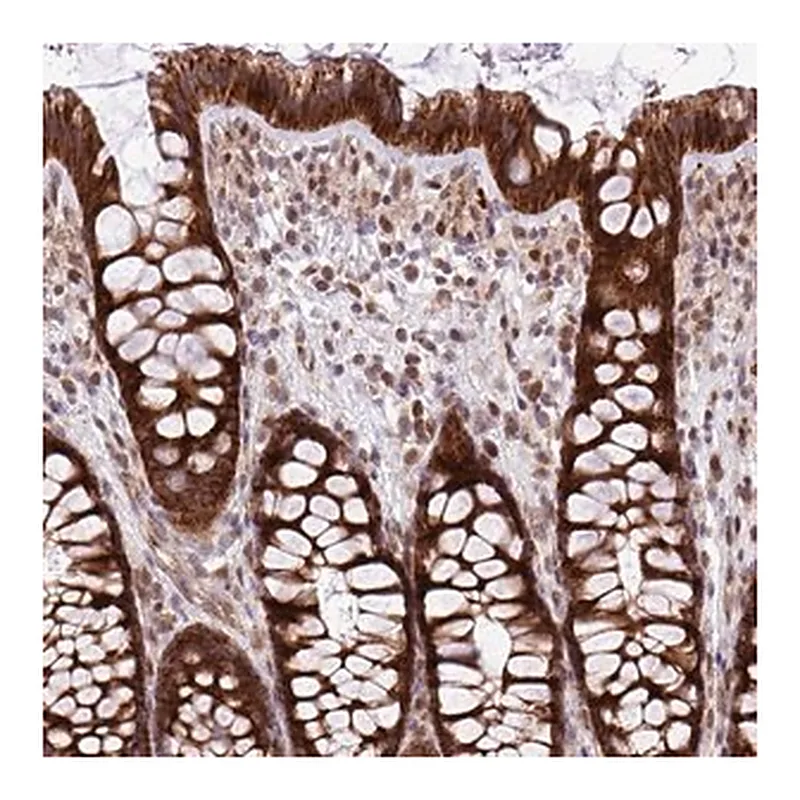 Merck Anti-B3GNT9 antibody produced in rabbit