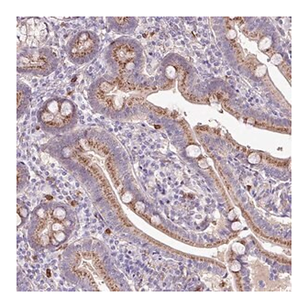 Merck Anti-CHST11 antibody produced in rabbit