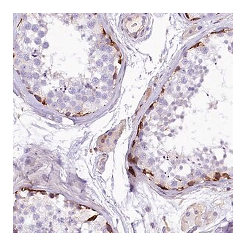 Merck Anti-CMTR2 antibody produced in rabbit
