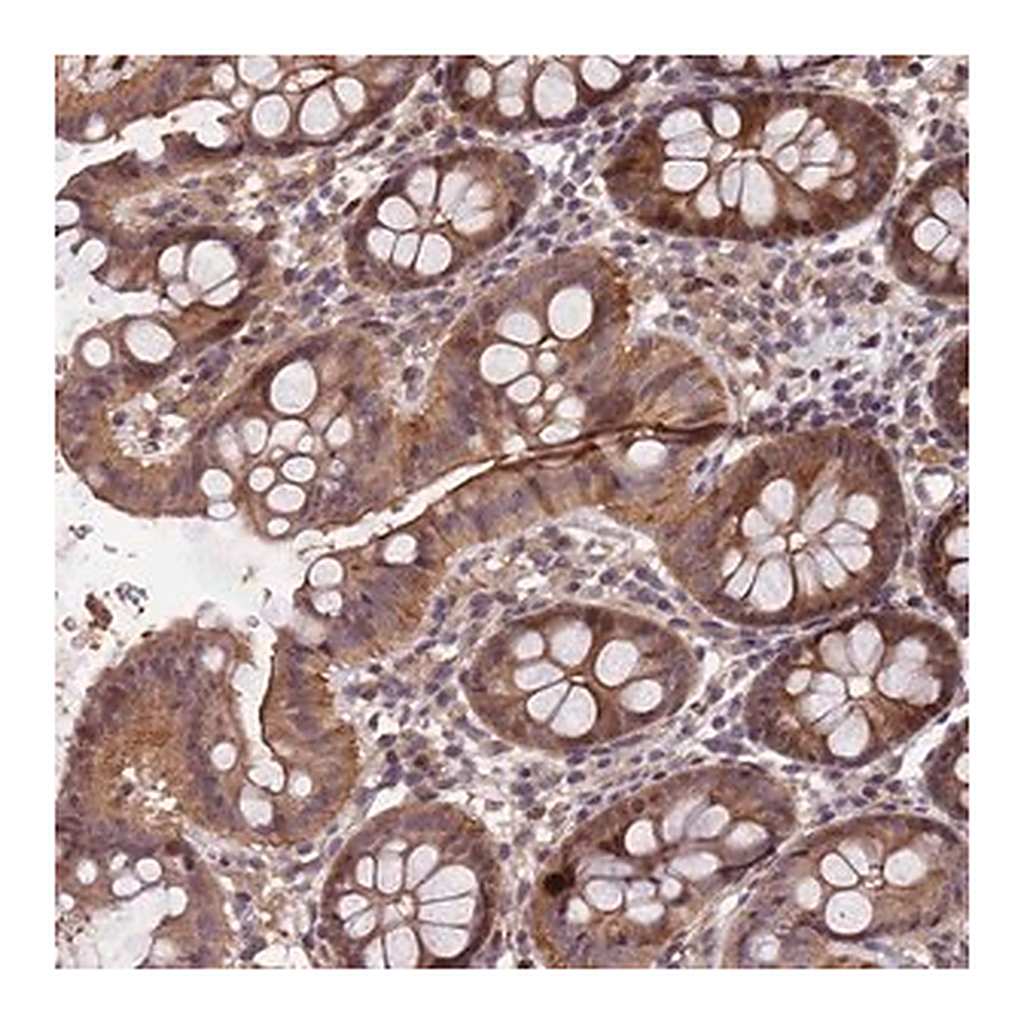 Merck Anti-CCDC184 antibody produced in rabbit