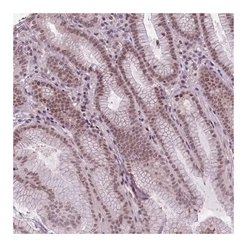 Merck Anti-TIGD1 antibody produced in rabbit