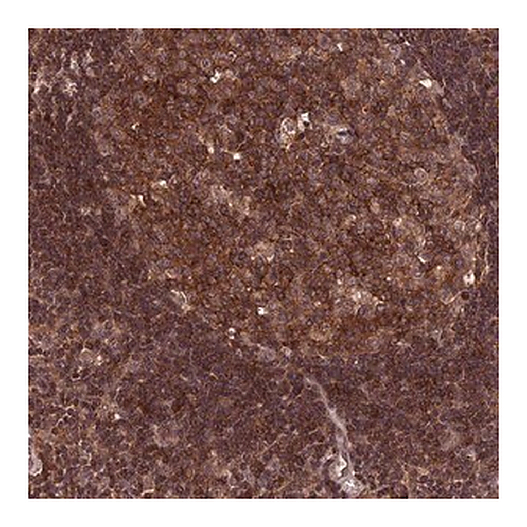 Merck Anti-PKD2L2 antibody produced in rabbit