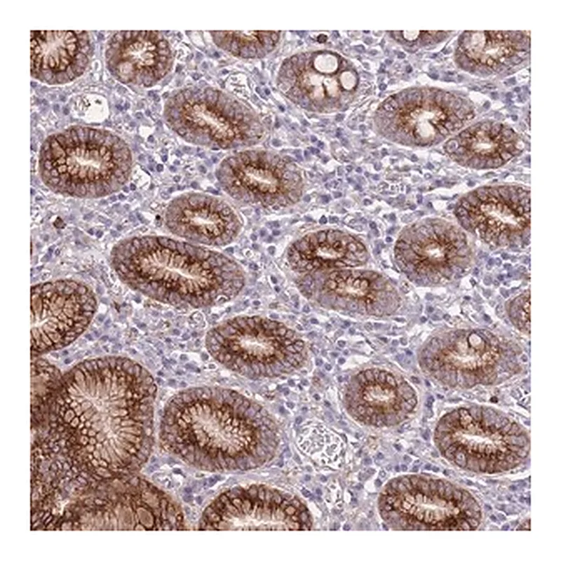 Merck Anti-RGS11 antibody produced in rabbit