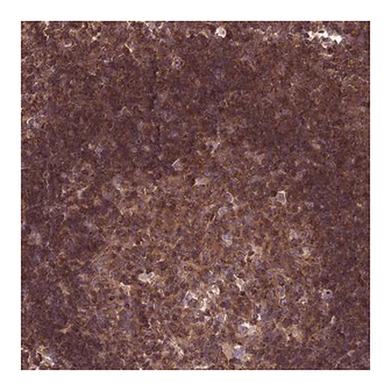 Merck Anti-KIAA0922 antibody produced in rabbit