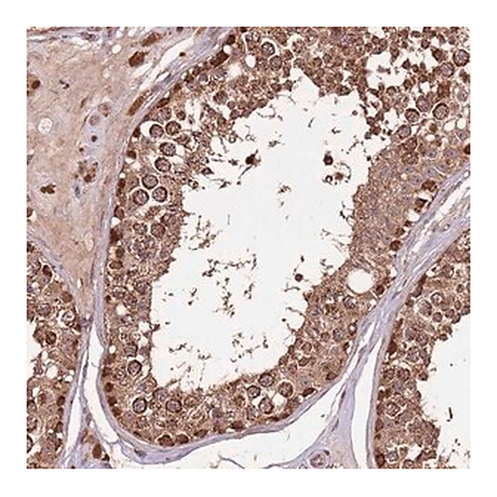 Merck Anti-IL17RD antibody produced in rabbit