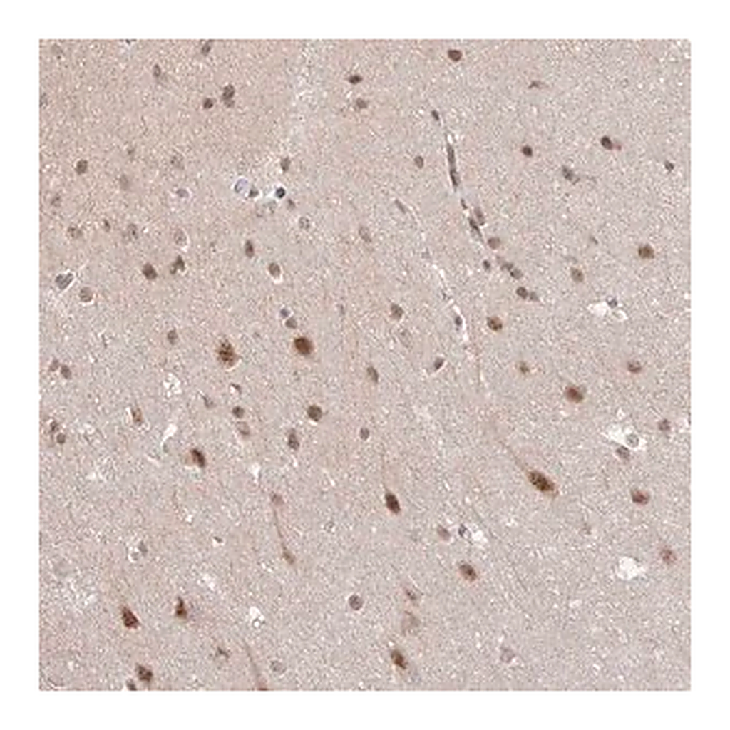 Merck Anti-NEIL1 antibody produced in rabbit
