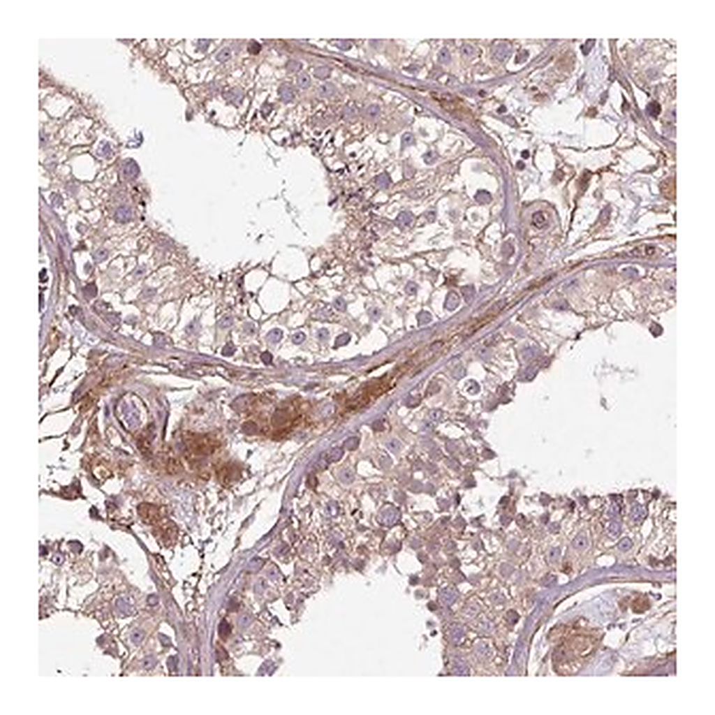 Merck Anti-CCDC93 antibody produced in rabbit