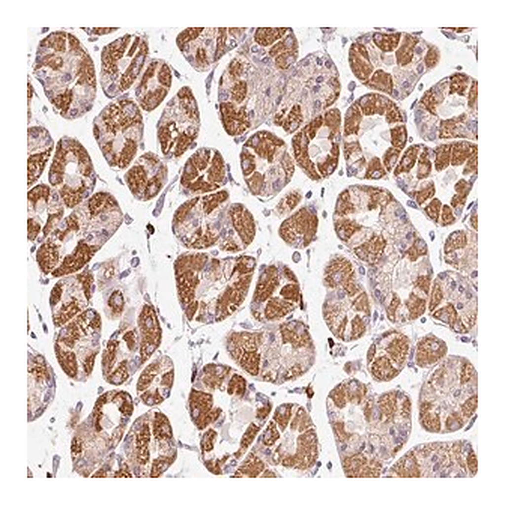 Merck Anti-PNPLA5 antibody produced in rabbit