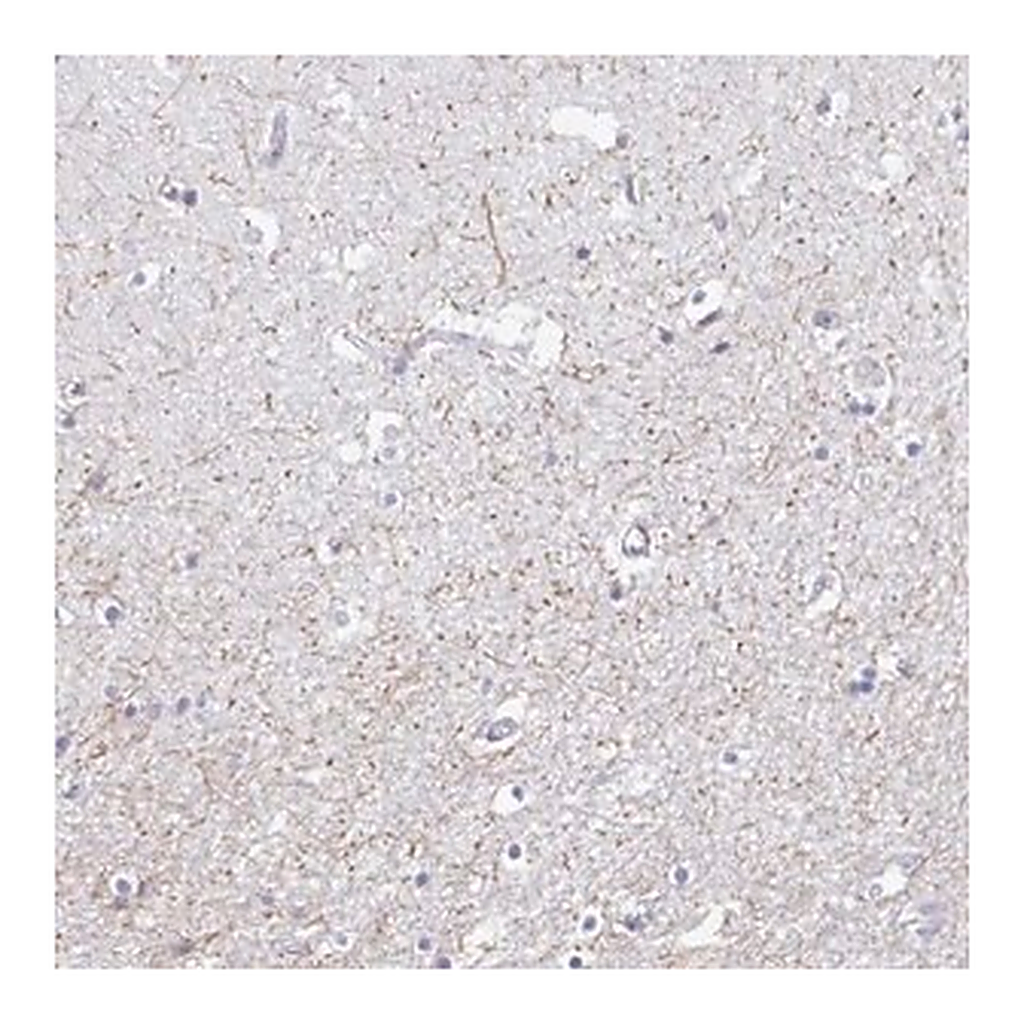 Merck Anti-SERTM1 antibody produced in rabbit