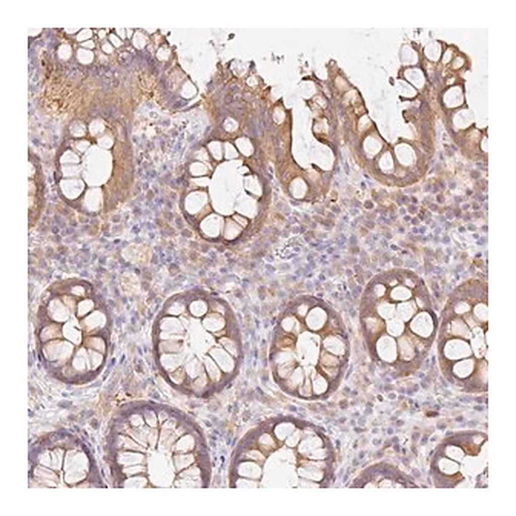 Merck Anti-DENND5A antibody produced in rabbit