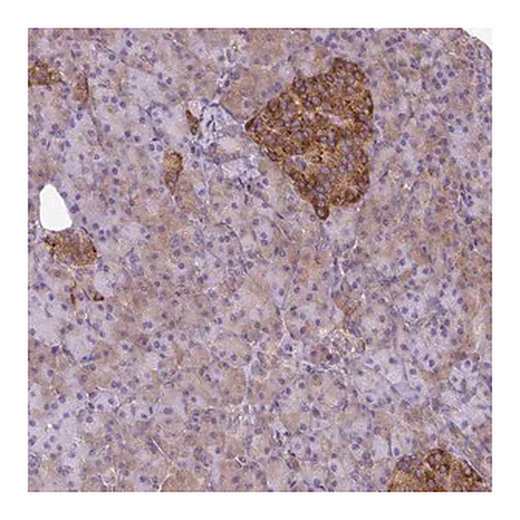 Merck Anti-TRIM17 antibody produced in rabbit