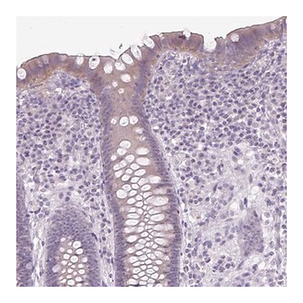 Merck Anti-NHSL2 antibody produced in rabbit