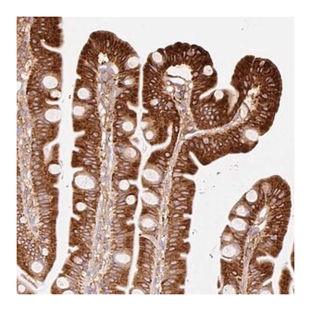 Merck Anti-MTTP antibody produced in rabbit