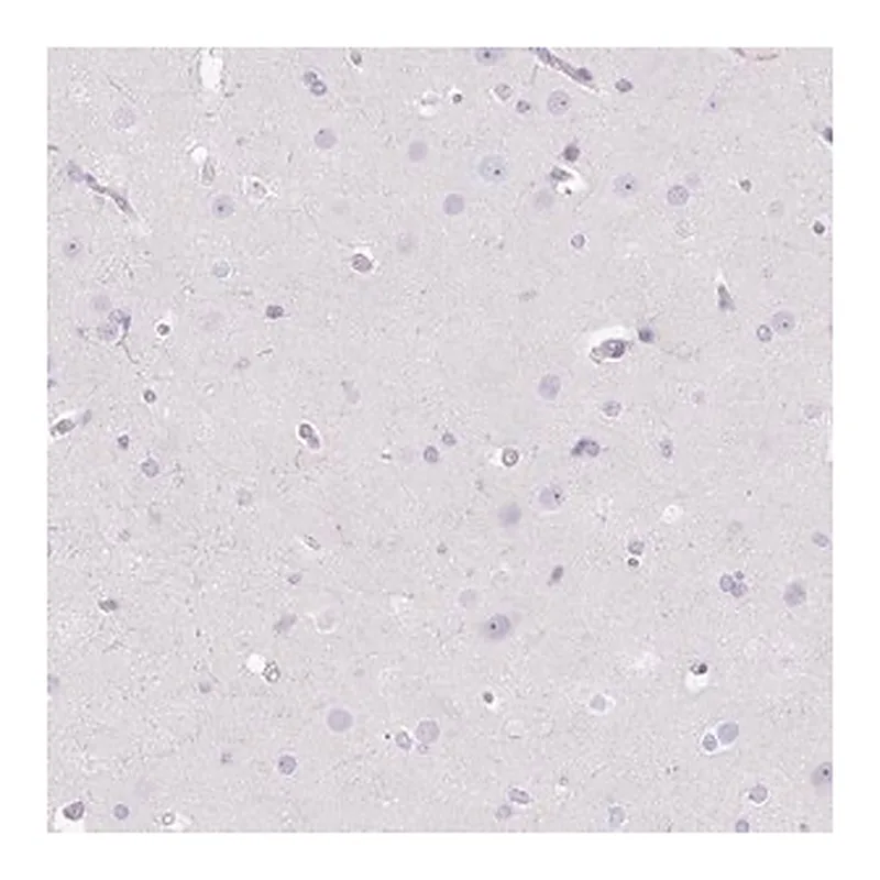 Merck Anti-DCAF17 antibody produced in rabbit