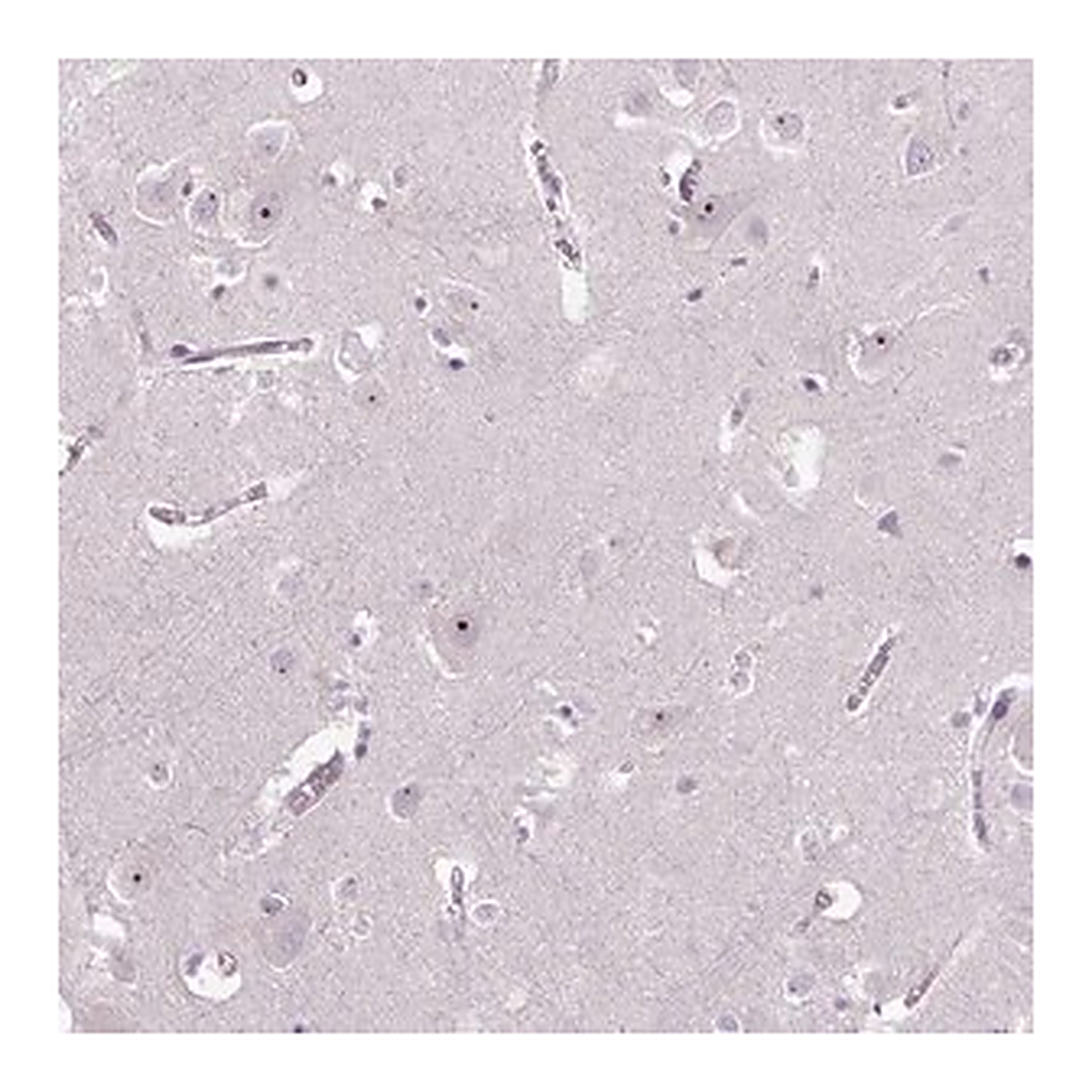 Merck Anti-TMEM151B antibody produced in rabbit