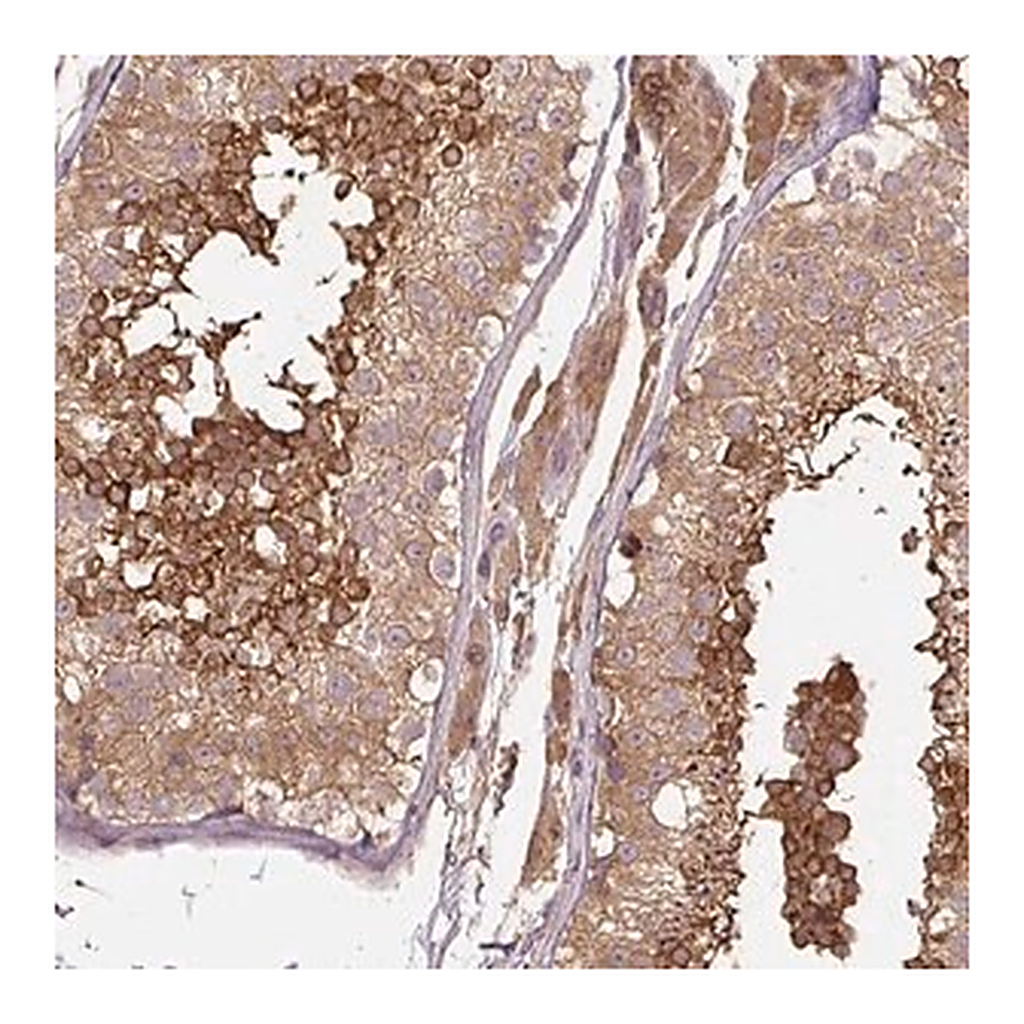 Merck Anti-C2orf73 antibody produced in rabbit