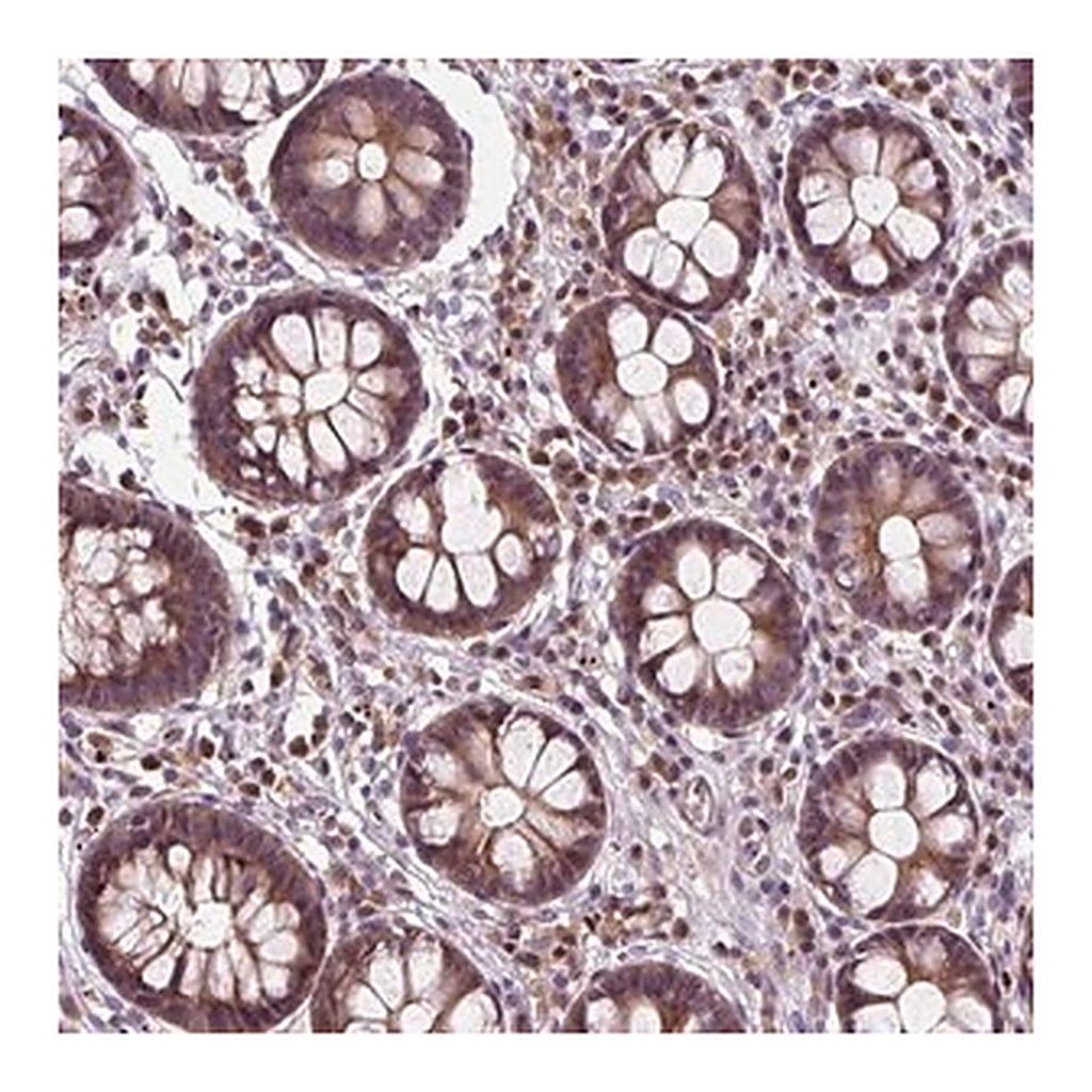 Merck Anti-ZNF555 antibody produced in rabbit