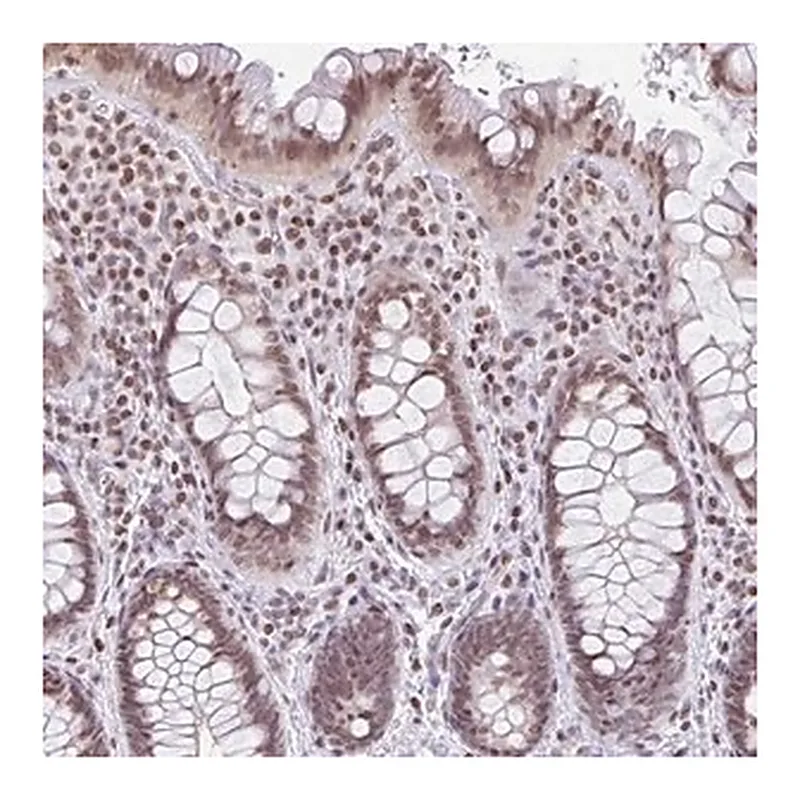 Merck Anti-NOL6 antibody produced in rabbit