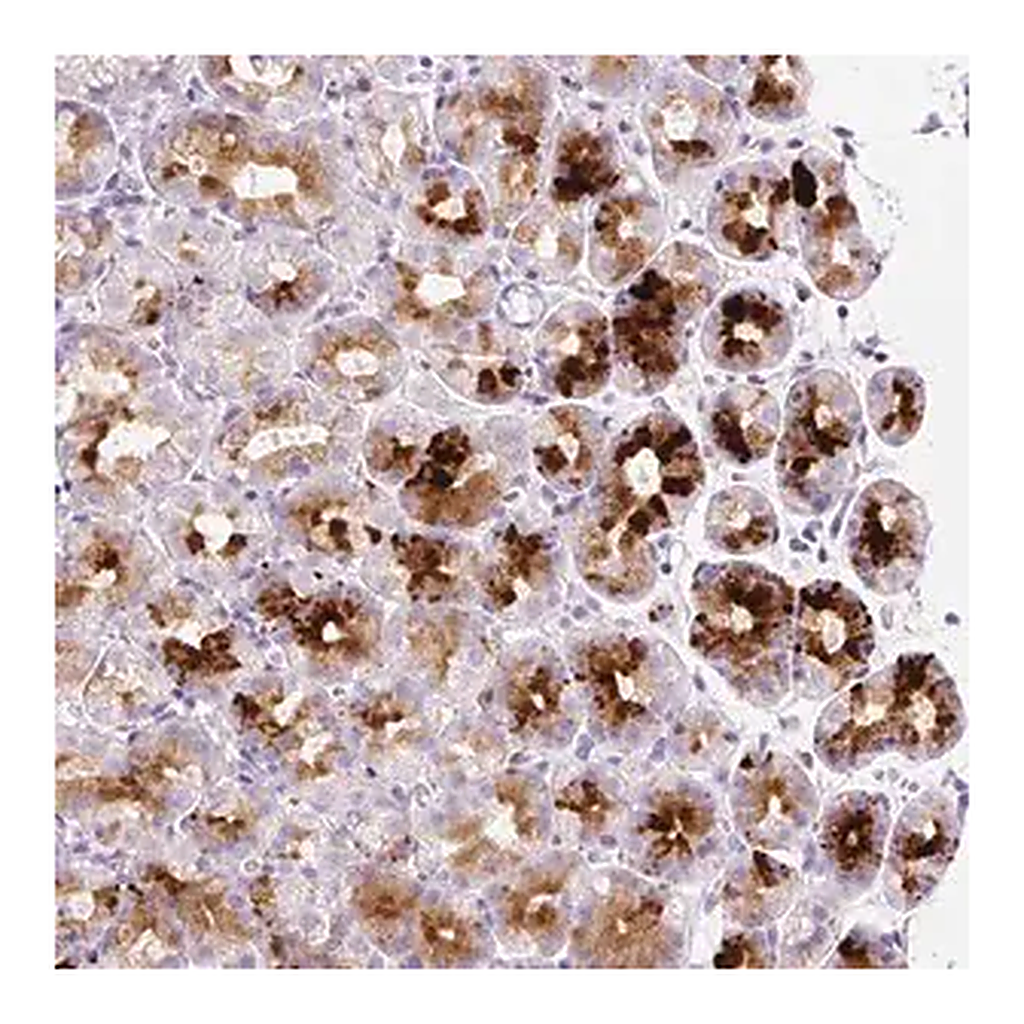 Merck Anti-SP140L antibody produced in rabbit