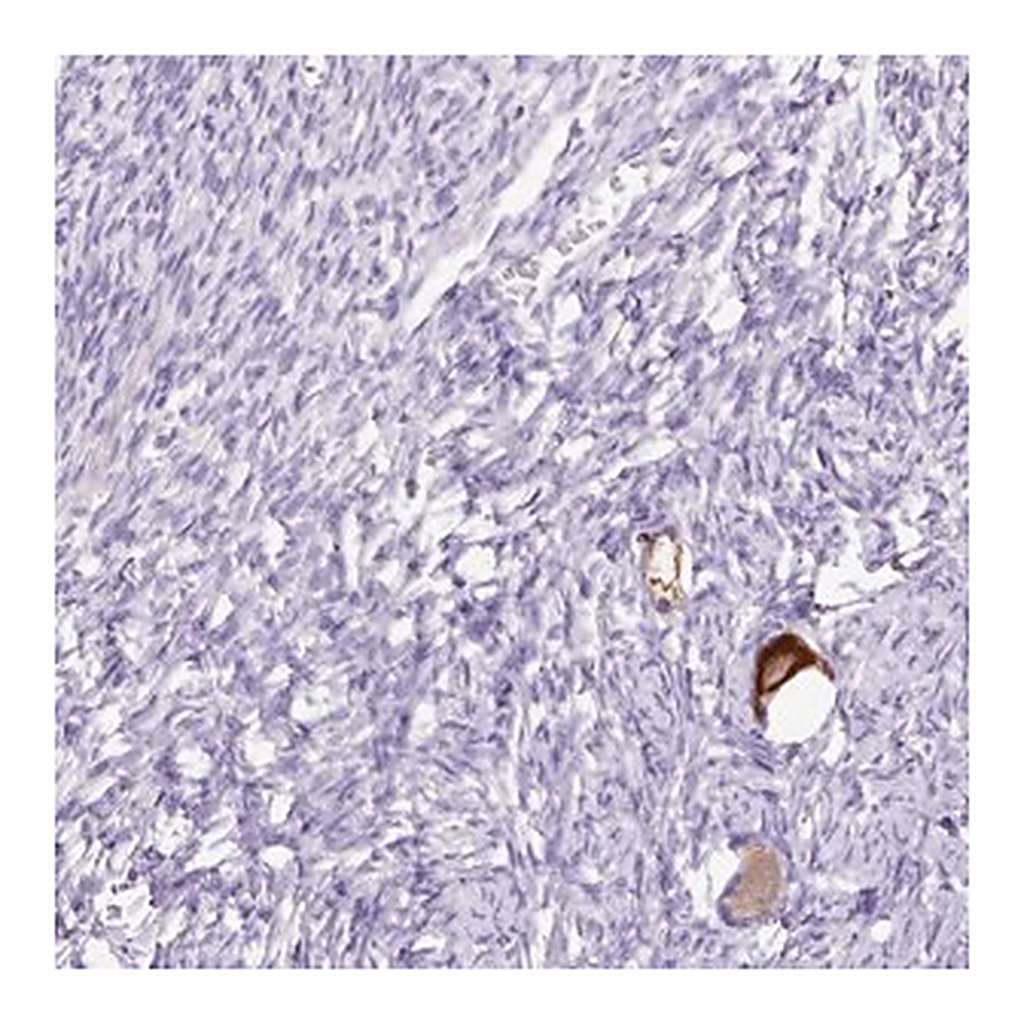 Merck Anti-GBX1 antibody produced in rabbit